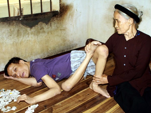 Củng cố cơ sở pháp lý cho vụ kiện của nạn nhân da cam Củng cố cơ sở pháp lý cho vụ kiện của nạn nhân da cam