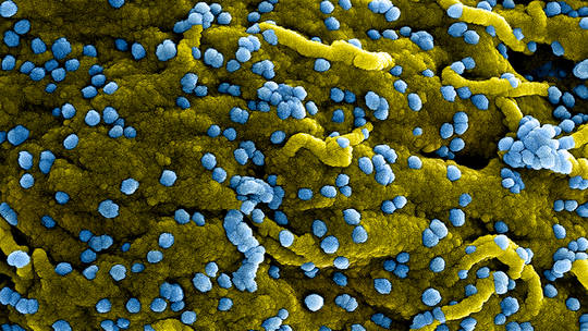 1907_virus_09161619072022.jpg