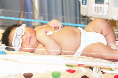 Bé sơ sinh cân nặng 7,3kg Bé sơ sinh cân nặng 7,3kg
