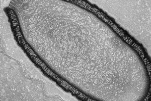 432014Pithovirus_sibericum.jpg