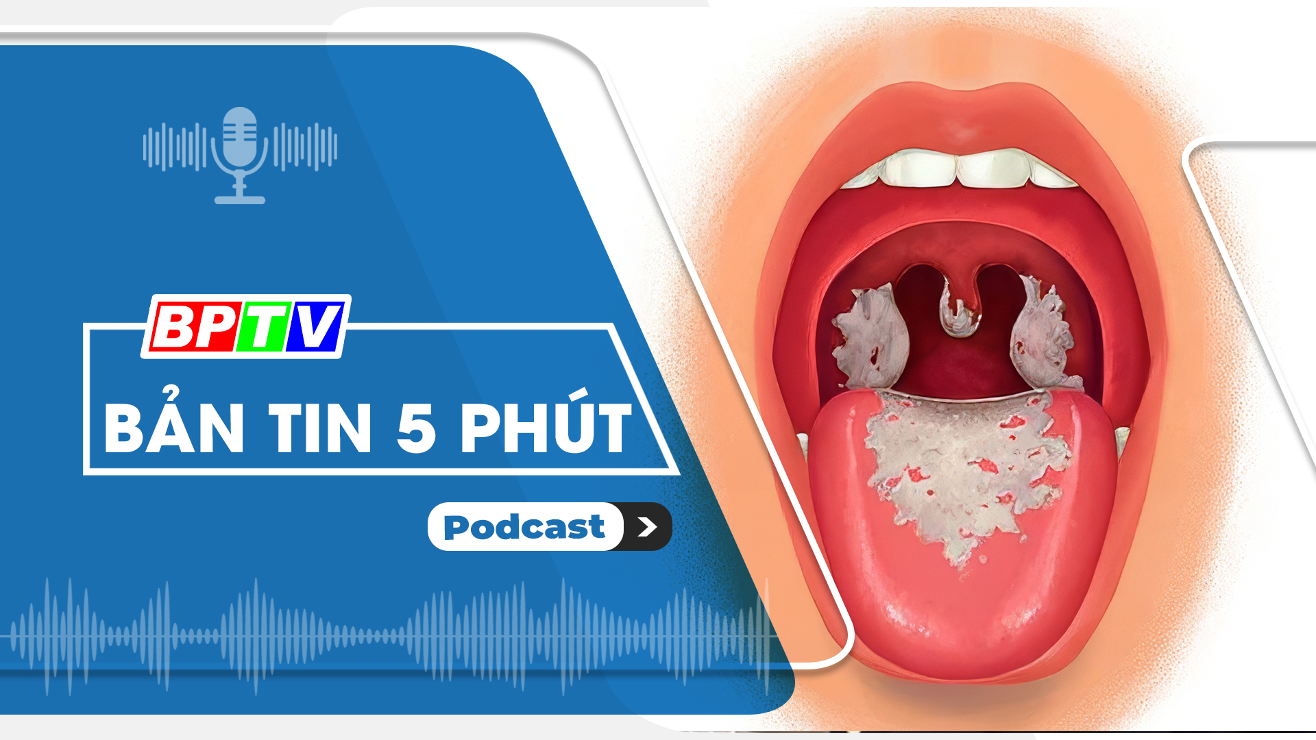 5 phút trưa nay 9-7-2024