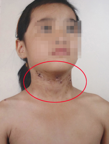 Trẻ con lại bị bạo hành