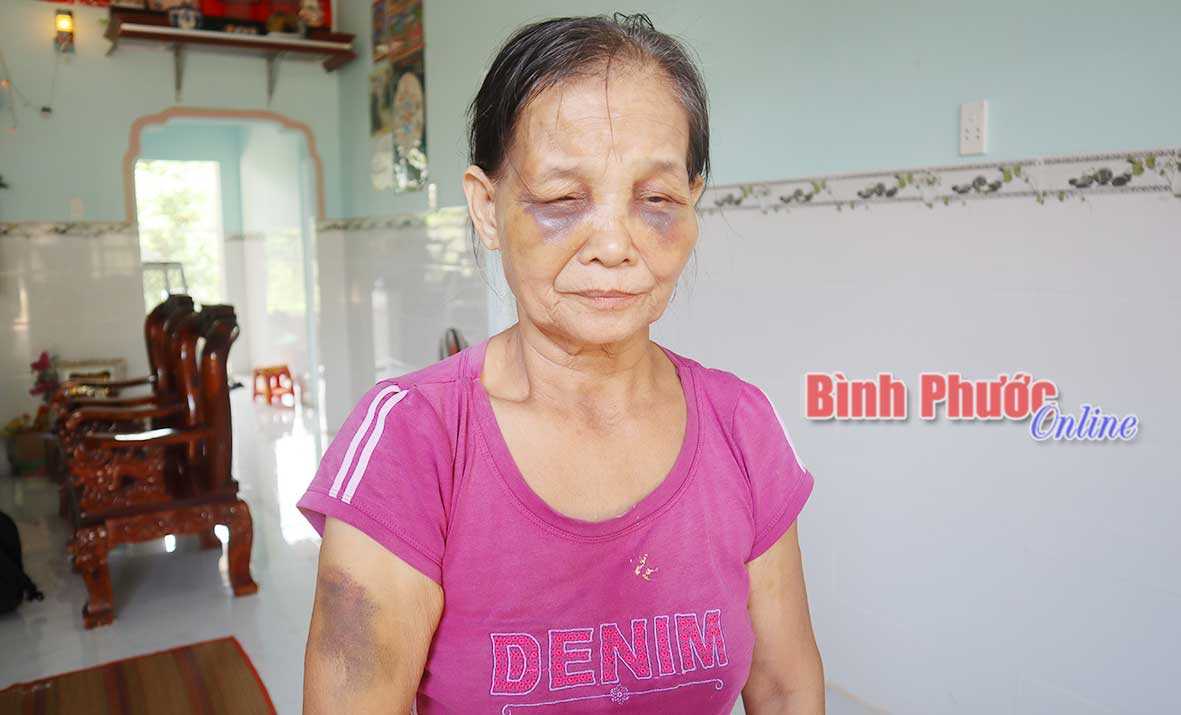 Vụ con dâu đánh mẹ chồng: Xử phạt hành chính và công khai xin lỗi mẹ chồng