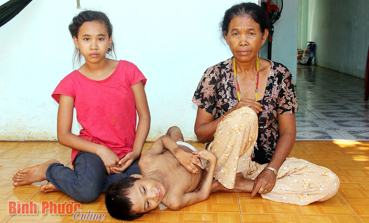 12 năm làm thuê nuôi cháu tật nguyền