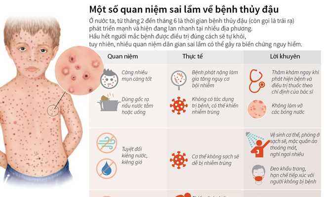 Một số quan niệm sai lầm về bệnh thủy đậu Một số quan niệm sai lầm về bệnh thủy đậu