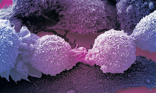 cancer1-2130923b-1787-1440476273(1).jpg