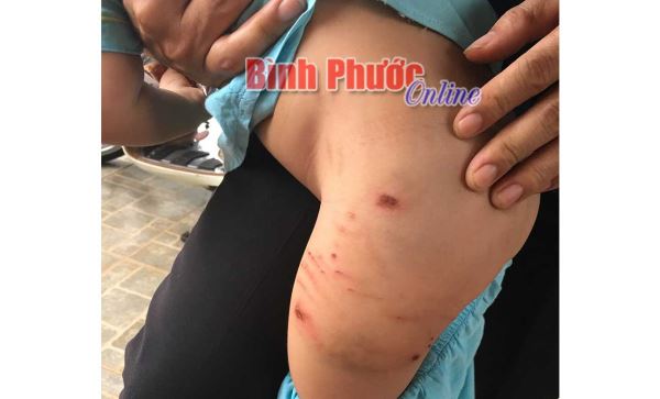 Bệnh dại ở động vật: Phòng hơn chữa bệnh Bệnh dại ở động vật: Phòng hơn chữa bệnh