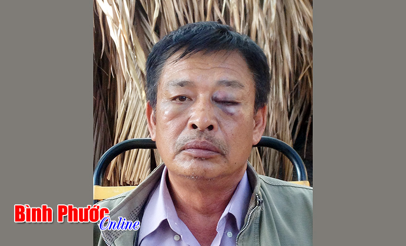 Thông tin thêm về vụ “Còn đâu tôn nghiêm chốn công đường?”