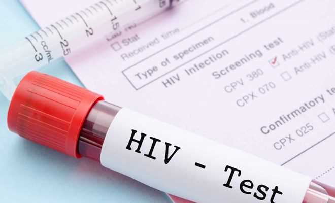 Tìm ra phương pháp xét nghiệm HIV mới cho kết quả nhanh nhất Tìm ra phương pháp xét nghiệm HIV mới cho kết quả nhanh nhất