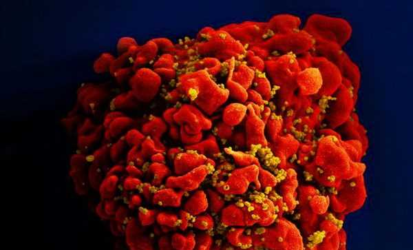Ca nhiễm virus HIV được chữa khỏi thứ 3 trên thế giới Ca nhiễm virus HIV được chữa khỏi thứ 3 trên thế giới