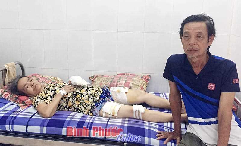 Vợ bỏng, chồng nghèo cầu cứu