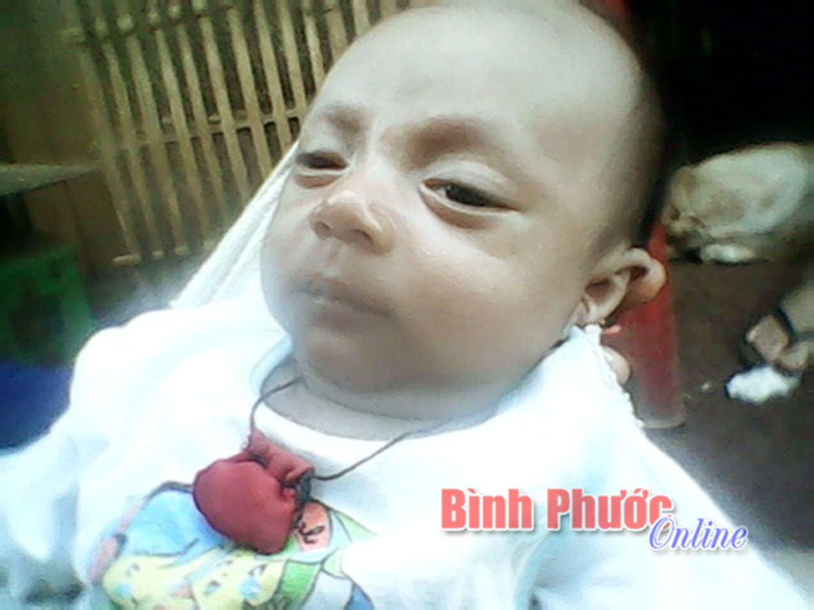 Cháu bé mồ côi cần được giúp đỡ
