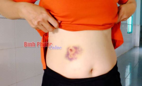 Cần xử nghiêm những người hành hung thai phụ Cần xử nghiêm những người hành hung thai phụ