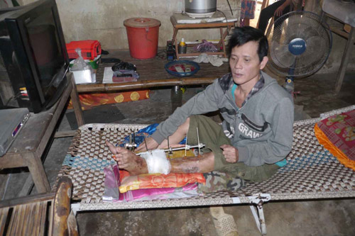 Suýt mất chân, tay bởi... bác sĩ Suýt mất chân, tay bởi... bác sĩ