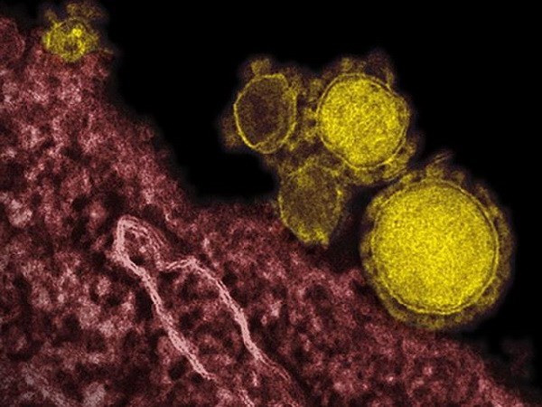 Số ca tử vong do MERS ở Saudi Arabia tăng lên 66 người
