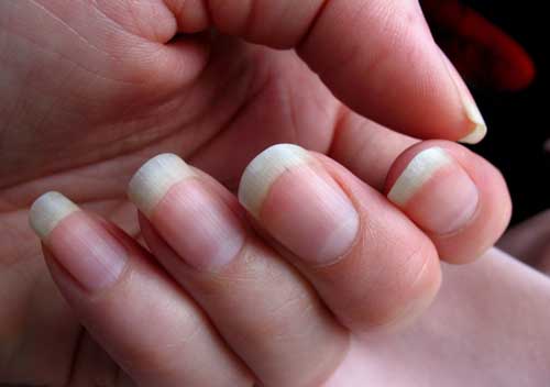 Nguyên nhân móng tay mọc nhanh hơn móng chân Nguyên nhân móng tay mọc nhanh hơn móng chân