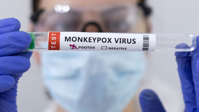 monkeypox_brown_230522_1653625164960397785310_15174427052022.jpeg