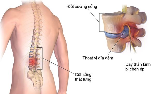 Đón xem chương trình trực tiếp “Sức khỏe cho mọi người” tháng 6-2020
