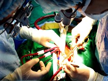 Cứu sống bệnh nhân bị vật sắc đâm xuyên động mạch ở cổ Cứu sống bệnh nhân bị vật sắc đâm xuyên động mạch ở cổ