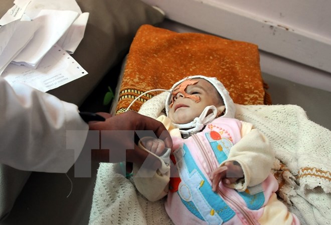 ttxvnyemen24012018082750.jpg