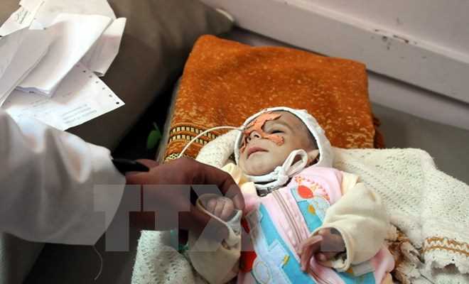 LHQ: Khoảng 22 triệu người Yemen đang cần viện trợ nhân đạo