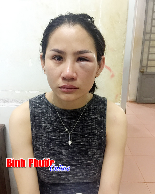 Thông tin thêm về bài báo: “Về đón con, bị chồng cũ hành hung” Thông tin thêm về bài báo: “Về đón con, bị chồng cũ hành hung”