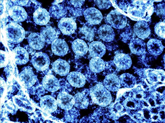 virus_110123_06494419082023.jpg